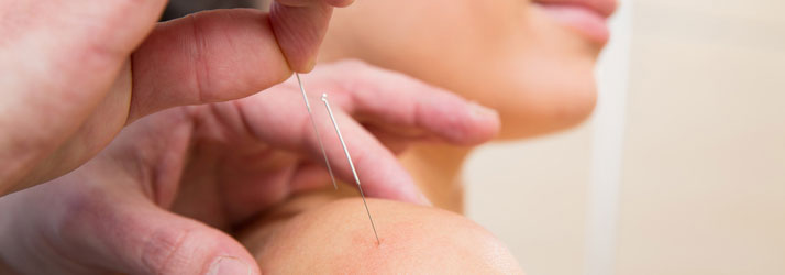 Chiropractic Centerville OH Should Pain Relief Acupuncture
